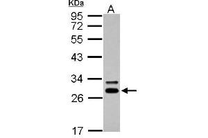 WB Image Sample (30 ug of whole cell lysate) A: A431 12% SDS PAGE antibody diluted at 1:5000 (DCK antibody  (Center))