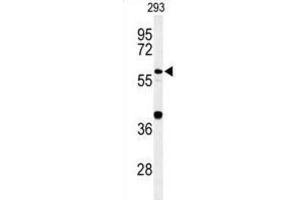 Western Blotting (WB) image for anti-Cell Division Cycle 45 Homolog (S. Cerevisiae) (CDC45) antibody (ABIN3004359)