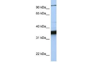 KIFC3 antibody used at 1 ug/ml to detect target protein.
