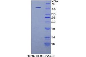 SDS-PAGE analysis of Human Fibrillin 1 Protein. (Fibrillin 1 Protein (FBN1))