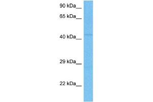 Host:  Mouse  Target Name:  NR1H3  Sample Tissue:  Mouse Testis  Antibody Dilution:  1ug/ml (NR1H3 antibody  (C-Term))