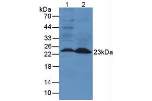 Figure. (Lipocalin 2 antibody  (AA 21-200))