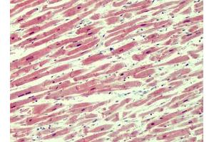 Human Heart: Formalin-Fixed, Paraffin-Embedded (FFPE) (IRAK4 antibody  (N-Term))
