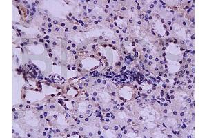 Formalin-fixed and paraffin embedded rat kidney tissue labeled with Anti-HGF Polyclonal Antibody, Unconjugated (ABIN736551) at 1:200, followed by conjugation to the secondary antibody and DAB staining (HGF antibody  (AA 201-300))