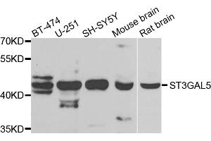 Western blot analysis of extracts of various cell lines, using ST3GAL5 antibody. (ST3GAL5 antibody)