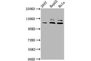 Western Blot Positive WB detected in: 293T whole cell lysate, HepG2 whole cell lysate, Hela whole cell lysate All lanes: MAP3K21 antibody at 3. (MLK4 antibody  (AA 640-794))