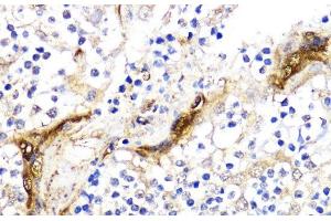 Immunohistochemistry of paraffin-embedded Human tonsil using BMPR1B Polyclonal Antibody at dilution of 1:200 (40x lens). (BMPR1B antibody)
