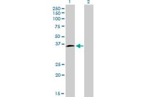 Western Blot analysis of HOXD8 expression in transfected 293T cell line by HOXD8 monoclonal antibody (M01), clone 10F8.