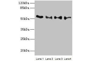 Western blot All lanes: TRIM15 antibody at 2 μg/mL Lane 1: Jurkat whole cell lysate Lane 2: Hela whole cell lysate Lane 3: HepG2 whole cell lysate Lane 4: A549 whole cell lysate Secondary Goat polyclonal to rabbit IgG at 1/10000 dilution Predicted band size: 53, 13 kDa Observed band size: 53 kDa (TRIM15 antibody  (AA 122-387))