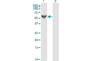 Western Blot analysis of PRF1 expression in transfected 293T cell line by PRF1 monoclonal antibody (M04), clone 3B4. (Perforin 1 antibody  (AA 461-555))