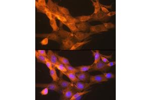 Immunofluorescence analysis of NIH-3T3 cells using tPA/tPA/PLAT Rabbit mAb (ABIN1678727, ABIN3018699, ABIN3018700 and ABIN7101650) at dilution of 1:100 (40x lens). (PLAT antibody)