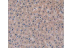 Figure. (APOA5 antibody  (AA 169-367))