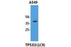 Cell lysates (40 ug) were resolved by SDS-PAGE, transferred to PVDF membrane and probed with TP53I3 antibody (1:3000).