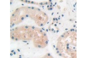 Figure. (ADAM15 antibody  (AA 211-451))