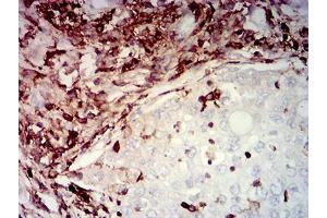 Immunohistochemistry (IHC) image for anti-Protein tyrosine Phosphatase, Receptor Type, C (PTPRC) (AA 431-577) antibody (ABIN5684125)