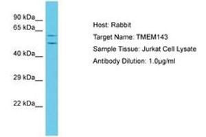 Image no. 1 for anti-Transmembrane Protein 143 (TMEM143) (C-Term) antibody (ABIN6750626) (TMEM143 antibody  (C-Term))