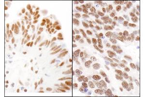 Immunohistochemistry (IHC) image for anti-Chromobox Homolog 3 (CBX3) (C-Term) antibody (ABIN7453951)
