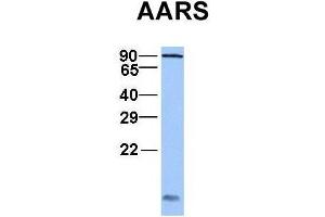 Host:  Rabbit  Target Name:  AARS  Sample Type:  Jurkat  Antibody Dilution:  1. (AARS antibody  (C-Term))