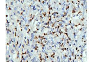 IHC analysis of LBR using anti-LBR antibody (ABIN6719340).
