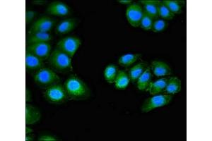 Immunofluorescent analysis of A549 cells using ABIN7165226 at dilution of 1:100 and Alexa Fluor 488-congugated AffiniPure Goat Anti-Rabbit IgG(H+L) (CUTA antibody  (AA 33-150))