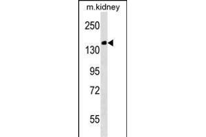 Mouse Casc5 Antibody (C-term) (ABIN1536748 and ABIN2838238) western blot analysis in mouse kidney tissue lysates (35 μg/lane). (CASC5 antibody  (C-Term))