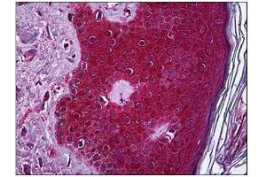 Immunohistochemistry (IHC) image for anti-Tumor Necrosis Factor alpha (TNF alpha) (AA 1-234) antibody (ABIN782382)