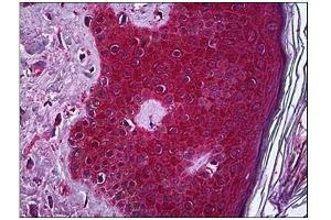 Immunohistochemistry (IHC) image for anti-Tumor Necrosis Factor alpha (TNF alpha) (AA 1-234) antibody (ABIN782382) (TNF alpha antibody  (AA 1-234))