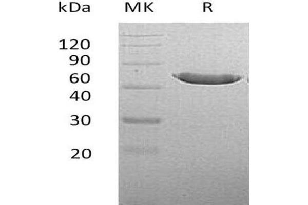 Carboxypeptidase A2 Protein (His tag)