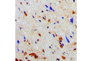 Immunohistochemical analysis of NAA15 staining in human brain formalin fixed paraffin embedded tissue section. (NAA15 antibody  (Center))