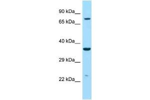 Western Blotting (WB) image for anti-Iduronidase, alpha-L- (IDUA) (C-Term) antibody (ABIN2789573) (IDUA antibody  (C-Term))