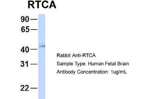 Host: Rabbit Target Name: RTCA Sample Type: Human Fetal Brain Antibody Dilution: 1. (RTCD1 antibody  (N-Term))