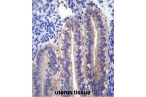 ANGPTL7 Antibody (C-term) immunohistochemistry analysis in formalin fixed and paraffin embedded human uterus tissue followed by peroxidase conjugation of the secondary antibody and DAB staining. (ANGPTL7 antibody  (C-Term))