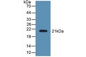 Figure. (LCN8 antibody  (AA 27-176))
