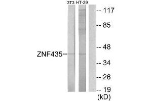Western Blotting (WB) image for anti-Zinc Finger and SCAN Domain Containing 16 (ZSCAN16) (Internal Region) antibody (ABIN1849976) (ZSCAN16 antibody  (Internal Region))