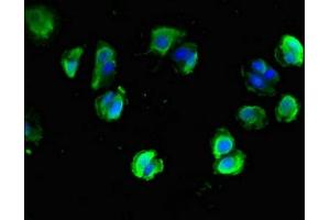 Immunofluorescent analysis of MCF-7 cells using ABIN7161314 at dilution of 1:100 and Alexa Fluor 488-congugated AffiniPure Goat Anti-Rabbit IgG(H+L) (Neuroligin 1 antibody  (AA 51-300))