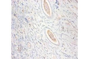 Immunohistochemistry of paraffin-embedded human kidney tissue using ABIN7148667 at dilution of 1:100 (CKMT1A antibody  (AA 40-417))