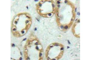 Used in DAB staining on fromalin fixed paraffin-embedded Kidney tissue (Thrombomodulin antibody  (AA 31-169))
