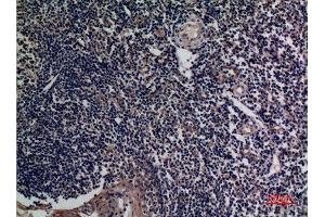Immunohistochemistry (IHC) analysis of paraffin-embedded Human Tonsils, antibody was diluted at 1:100.