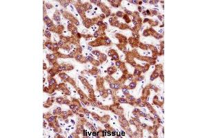 Immunohistochemistry (IHC) image for anti-Indian Hedgehog (IHH) antibody (ABIN2998360) (Indian Hedgehog antibody)