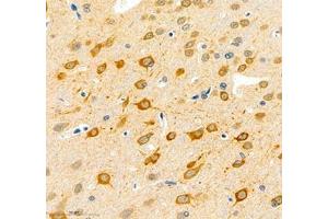 Immunohistochemistry (Paraffin-embedded Sections) (IHC (p)) image for anti-N-terminal EF-Hand Calcium Binding Protein 1 (NECAB1) antibody (ABIN7074753)