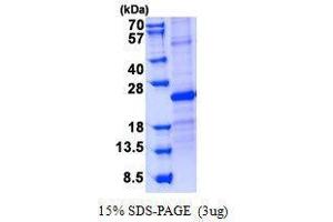 Figure annotation denotes ug of protein loaded and % gel used. (SOSTDC1 Protein)