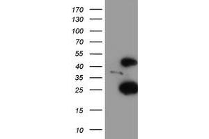 HEK293T cells were transfected with the pCMV6-ENTRY control (Left lane) or pCMV6-ENTRY CENPH (Right lane) cDNA for 48 hrs and lysed. (CENPH antibody)