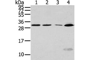 Gel: 12 % SDS-PAGE, Lysate: 40 μg, Lane 1-4: Hela, Jurkat and hepg2 cell, human fetal liver tissue, Primary antibody: ABIN7128017(SIAH1 Antibody) at dilution 1/300 dilution, Secondary antibody: Goat anti rabbit IgG at 1/8000 dilution, Exposure time: 1 minute (SIAH1 antibody)