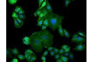 Immunofluorescence (IF) image for anti-Epidermal Growth Factor Receptor (EGFR) antibody (Alexa Fluor 488) (ABIN2657499)