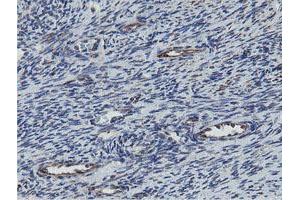 Image no. 2 for anti-Mitochondrial Ribosomal Protein S27 (MRPS27) (AA 151-414) antibody (ABIN1490969) (MRPS27 antibody  (AA 151-414))