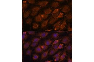 Immunofluorescence analysis of C6 cells using CREB3 antibody (ABIN6128862, ABIN6139013, ABIN6139015 and ABIN6222241) at dilution of 1:100. (CREB3 antibody  (AA 1-230))