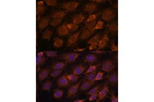 Immunofluorescence analysis of C6 cells using CREB3 antibody (ABIN6128862, ABIN6139013, ABIN6139015 and ABIN6222241) at dilution of 1:100.