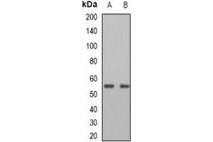 Western blot analysis of ATGL expression in A549 (A), HepG2 (B) whole cell lysates. (PNPLA2 antibody)