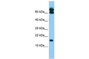 Host: Rabbit Target Name: B9D2 Sample Type: Fetal Brain lysates Antibody Dilution: 1.