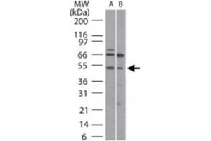 Western blot analysis of RUNX1 in (A) human Ramos and (B) mouse Raw cell lysate using RUNX1 polyclonal antibody  at 5 ug/mL . (RUNX1 antibody  (AA 231-245))